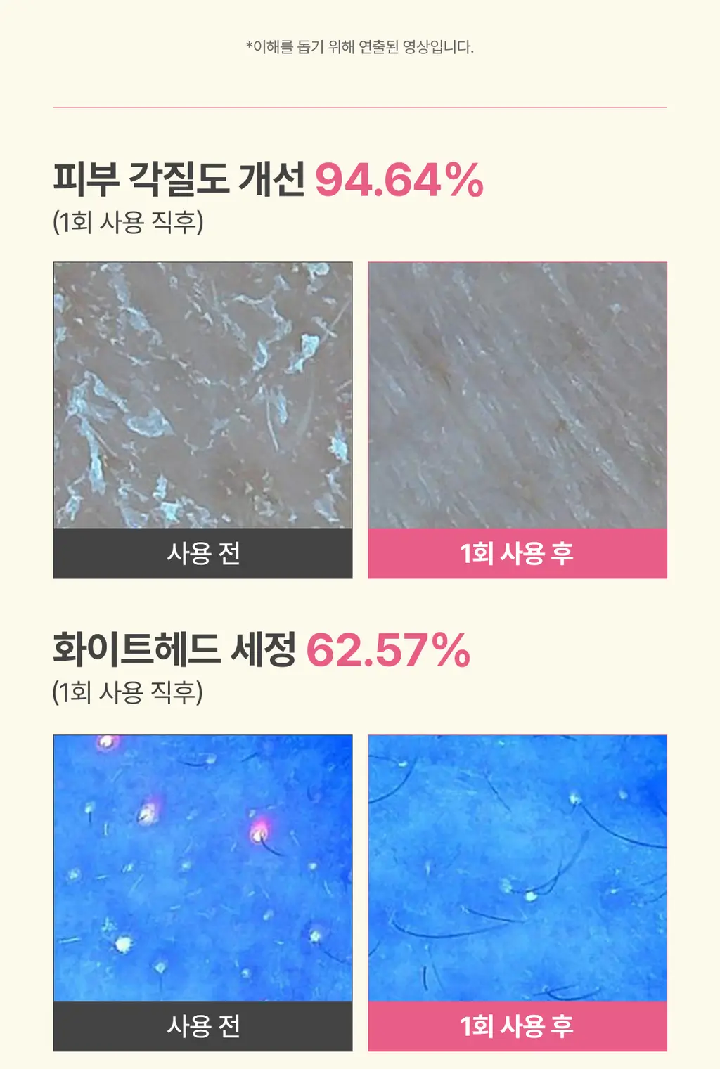 [저자극결케어] 아임프롬 피그 엔자임 파우더 클렌저 50g 상세페이지 11